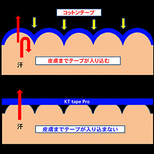 KTテープ｜光HIKARI.整骨院